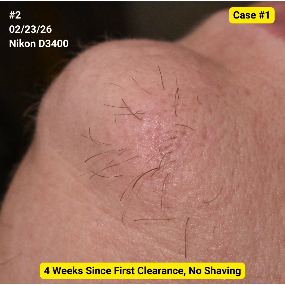 Photo of Hair